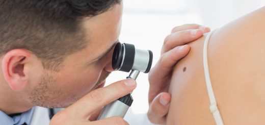 Understanding the Different Skin Cancer Types and How to Prevent Them