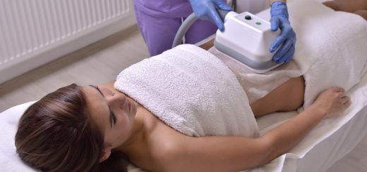 What Are the Benefits of CoolSculpting?
